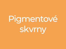Pigmentové skvrny