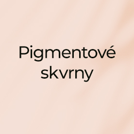 Pigmentové skvrny