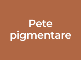 Pete pigmentare