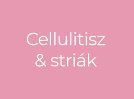 Cellulitisz & striák