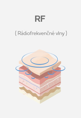 RF – Rádiofrekvenčné vlny