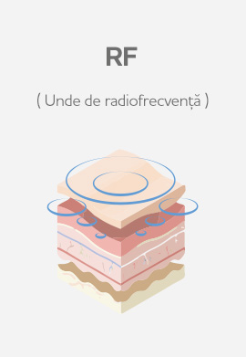 RF - unde de radiofrecvență