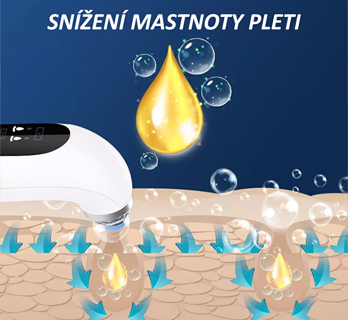 Kosmetický přístroj na čištění pleti Poremax Oxygen
