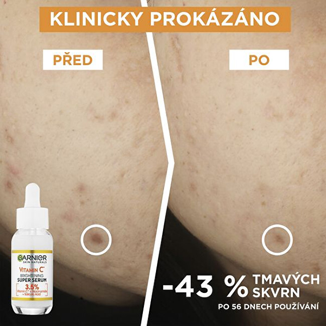 Rozjasňující pleťové sérum s vitamínem C (Brightening Serum) 30 ml
