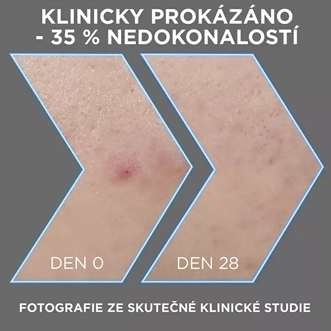 Sérum proti nedokonalostem pleti AHA + BHA Charcoal (Serum) 30 ml