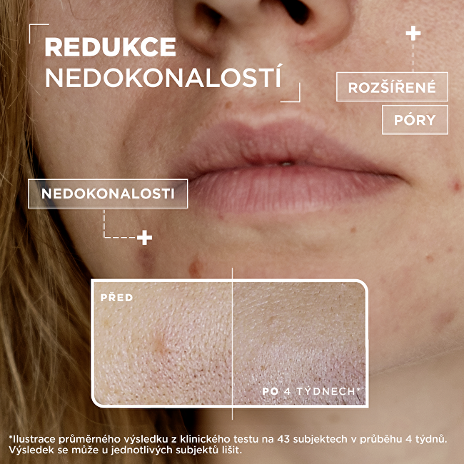 Sérum proti nedokonalostem pleti Anti-Imperfection (Serum) 30 ml