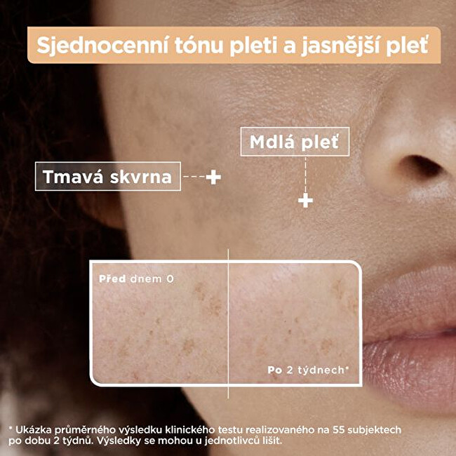 Sérum s vitamínem C proti pigmentovým skvrnám Anti-Dark Spot (Serum) 30 ml