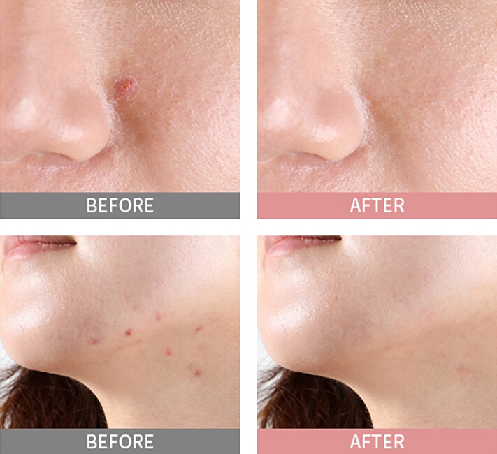Noční sérum s pudrem proti akné Pink Spot Good Bye Blemish (Overnight Spot Care) 19 ml