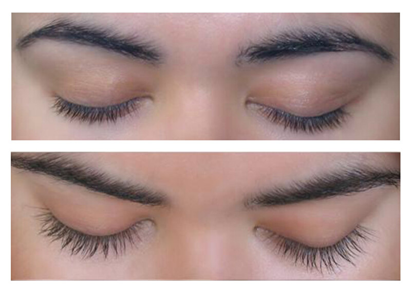 Sérum pro aktivní růst řas a obočí (Lash & Brow Activating Serum) 5 ml