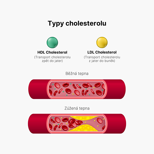 BrainMax Cholesterol Support – Pro udržení normální hladiny cholesterolu 100 kapslí