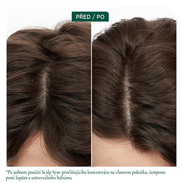 Univerzální balzám pro všechny typy vlasové pokožky Scalp Sync (Universal Conditioner) 200 ml