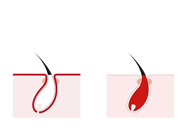 Îngrijire pentru creșterea părului si împotriva căderii parului pentru bărbați Transdermic grad 200 (fazele inițiale) 20 x 3,5 ml