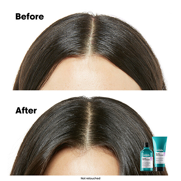 Sampon érzékeny fejbőrre Scalp Advanced Anti-Discomfort Dermo (Regulator Shampoo)