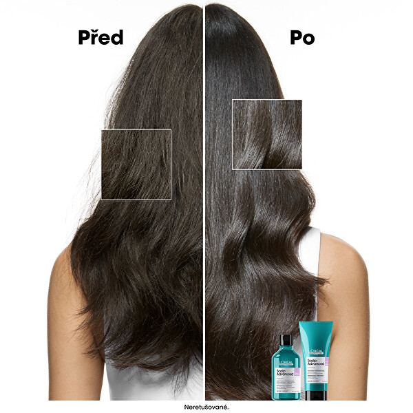 Šampon pro citlivou pokožku hlavy Scalp Advanced Anti-Discomfort Dermo (Regulator Shampoo)