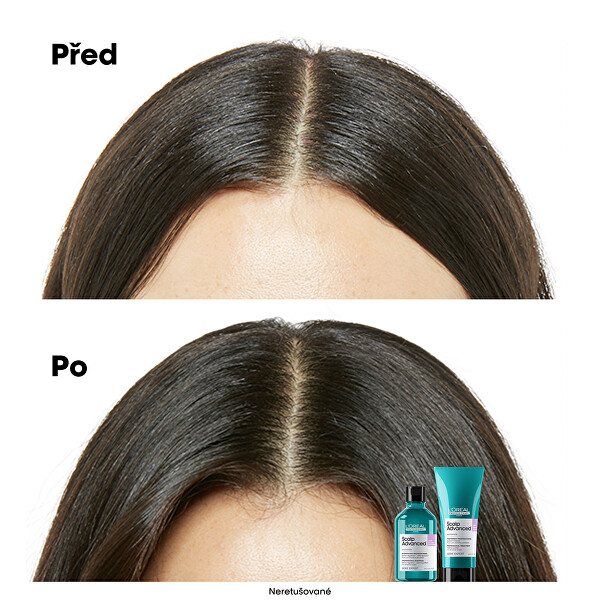 Šampon pro citlivou pokožku hlavy Scalp Advanced Anti-Discomfort Dermo (Regulator Shampoo)