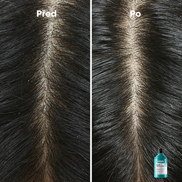 Šampon proti lupům Scalp Advanced (Anti-Dandruff Dermo Clarifier Shampoo)