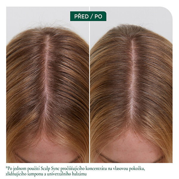 Zklidňující šampon pro suchou a citlivou pokožku hlavy Scalp Sync (Calming Shampoo)