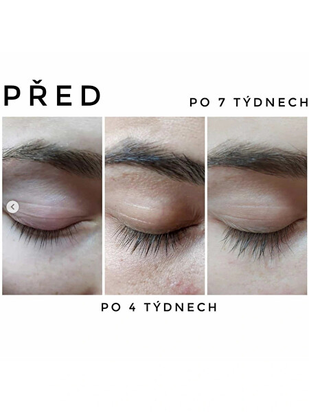 Růstové sérum pro řasy a obočí Hairplus 4,5 ml