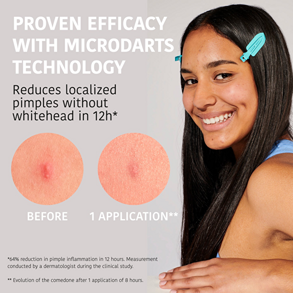 Mikrojehličkové náplasti na akné Microdarts Pimple Patches 12 ks