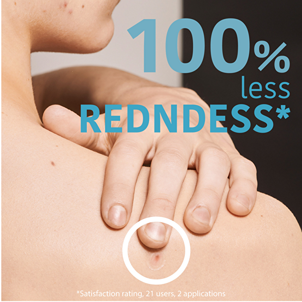 Náplasti na akné a nedokonalosti pleti SOS Pimple Patches 18 ks