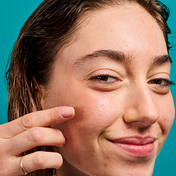 Náplasti na akné a nedokonalosti pleti SOS Pimple Patches 18 ks