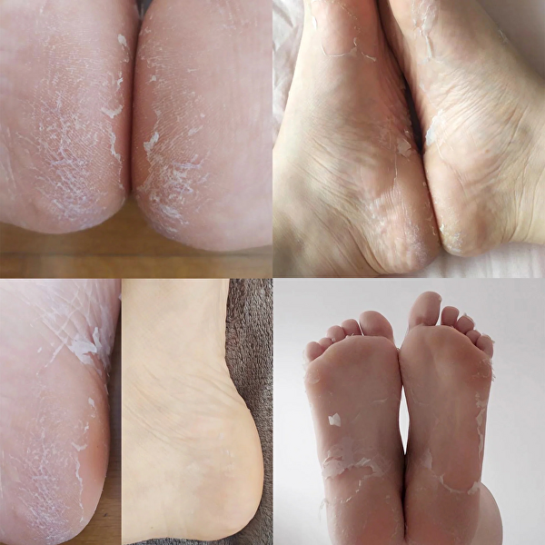 Peelingová a exfoliační maska na nohy Peeling Foot Mask 1 pár