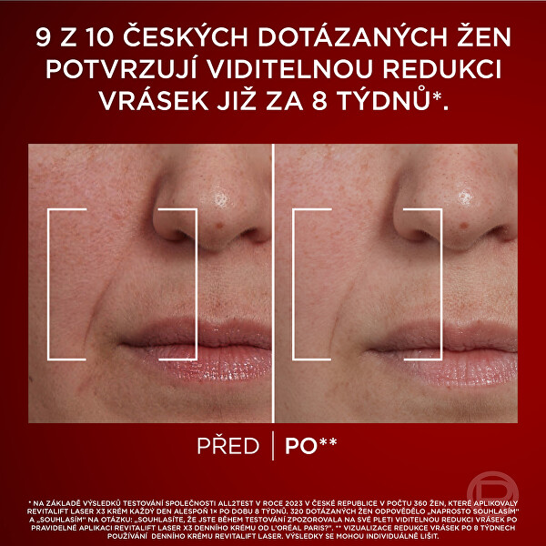 Dárková sada pleťové péče Revitalift Laser