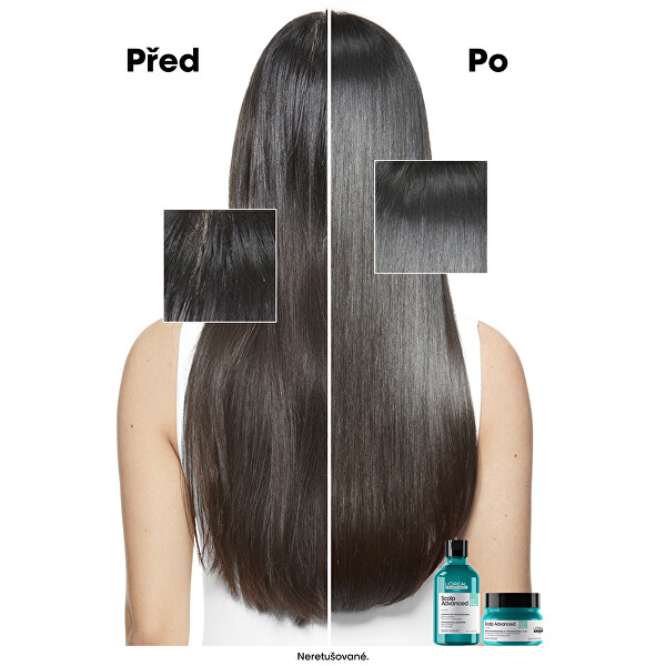 Šampon a maska pro mastnou pokožku hlavy 2 v 1 Scalp Advanced (Anti-Oiliness 2-in-1 Clay) 250 ml