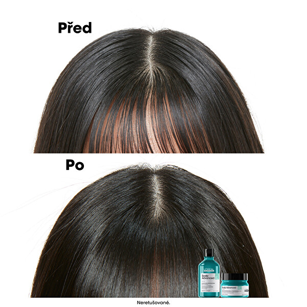 Šampon a maska pro mastnou pokožku hlavy 2 v 1 Scalp Advanced (Anti-Oiliness 2-in-1 Clay) 250 ml