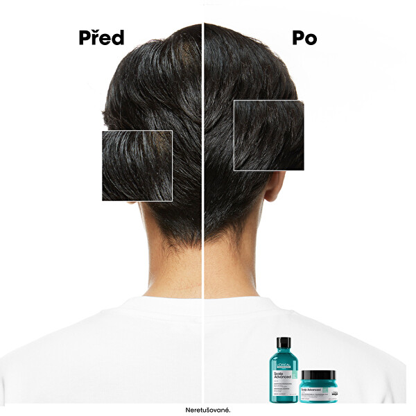 Šampon a maska pro mastnou pokožku hlavy 2 v 1 Scalp Advanced (Anti-Oiliness 2-in-1 Clay) 250 ml