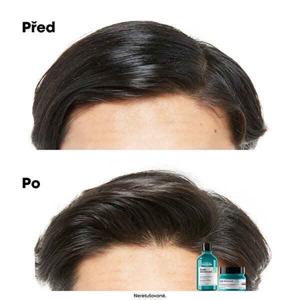 Šampon a maska pro mastnou pokožku hlavy 2 v 1 Scalp Advanced (Anti-Oiliness 2-in-1 Clay) 250 ml