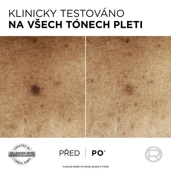 Sérum proti tmavým skvrnám s niacinamidem Bright Reveal (Dark Spot Serum) 30 ml