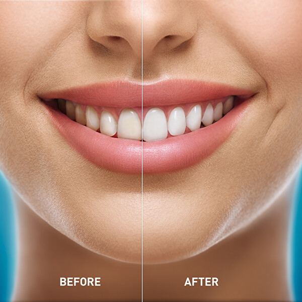 Bělicí zubní pasta (Whitening Toothpaste) 50 ml