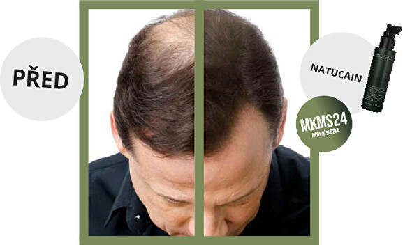 Vlasové tonikum ve spreji na podporu růstu vlasů (Natural Hair Activator) 100 ml