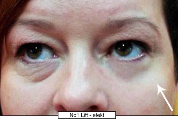 Revoluční oční krém s okamžitým efektem No.1 Lift (Eye Cream) 15 ml
