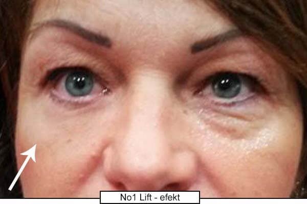Forradalmi szemkörnyékápoló krém azonnali hatással No.1 Lift (Eye Cream) 15 ml
