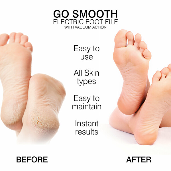 Elektrický pilník na chodidla s vakuovým odsáváním Go Smooth