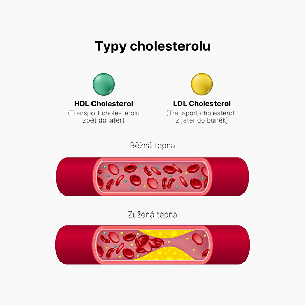 Cholesterol Support – Pro udržení normální hladiny cholesterolu 100 kapslí